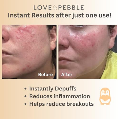 Beauty Pops - Love & Pebble Turmeric Mask Glow