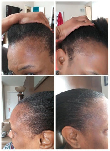 Kreyol Essence - Rosemary Peppermint Haitian Black Castor Oil