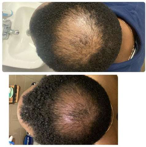 Kreyol Essence - Scalp Care Conditioner with Haitian Black Castor Oil